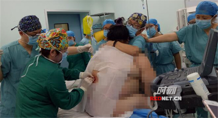 16名医生为280斤危重孕妇生二胎，现场情况惊心动魄